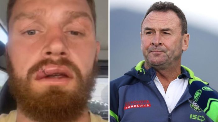 Jack Wighton to captain Canberra Raiders this weekend after Elliott Whitehead’s horror injury