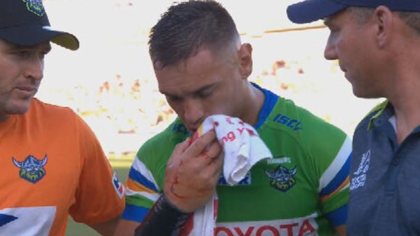 Officials left searching for 'missing teeth' as Danny Levi's injury sours gritty Raiders win