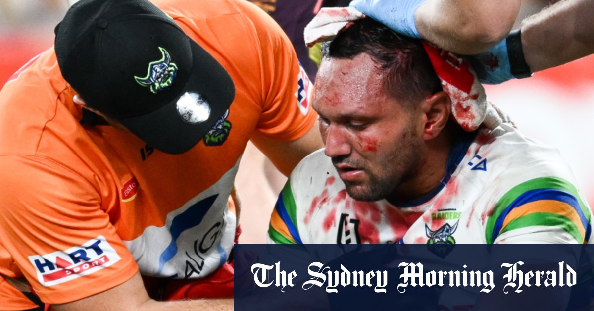 18 stitches for Rapana as Taupau learns judiciary fate from brutal collision