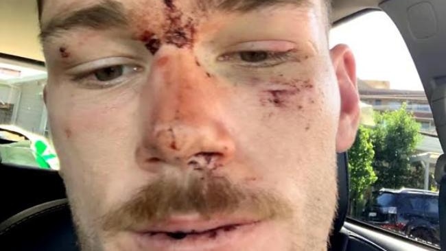 NSW police officers under investigation over arrest of Canberra Raiders hooker Tom Starling