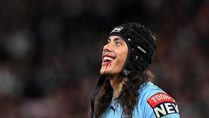 A man in a helmet smiles as blood dribbles from his lip.