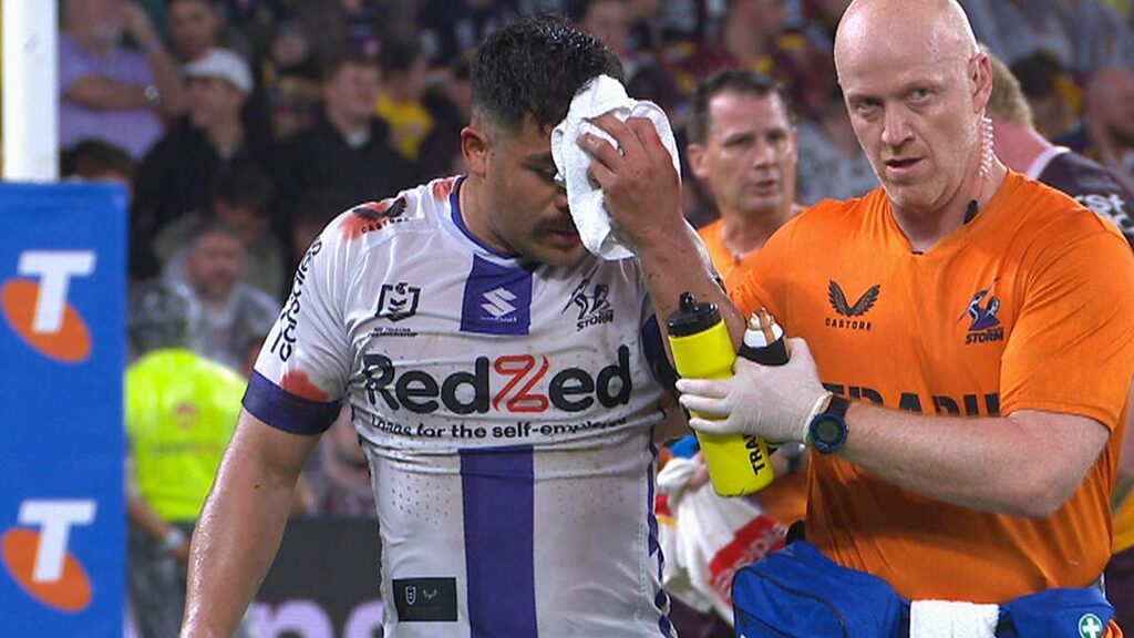 Storm flyer’s ugly head knock as returning star injected in to the game: NRL Casualty Ward