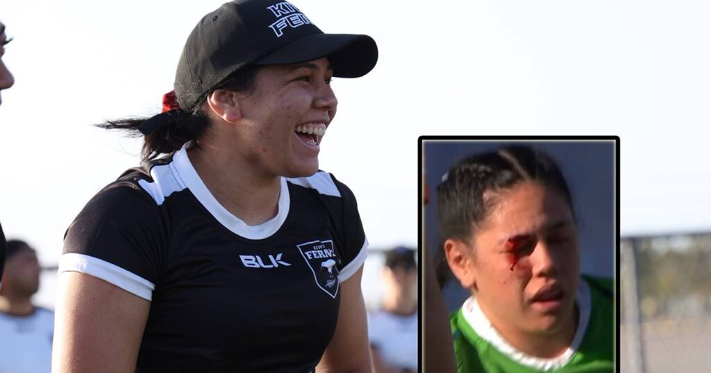 Canberra Raiders' Cheyelle Robins-Reti awaits Kiwi Ferns debut as face fracture nears recovery