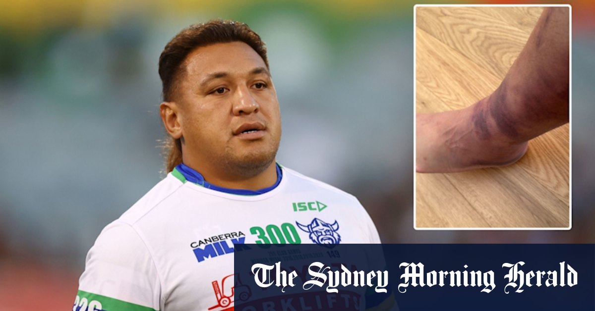 Josh Papalii Dismisses Injury Mind Games Concerns