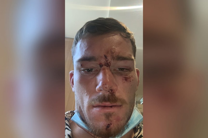 Conflicting claims as cops fight Tom Starling assault case